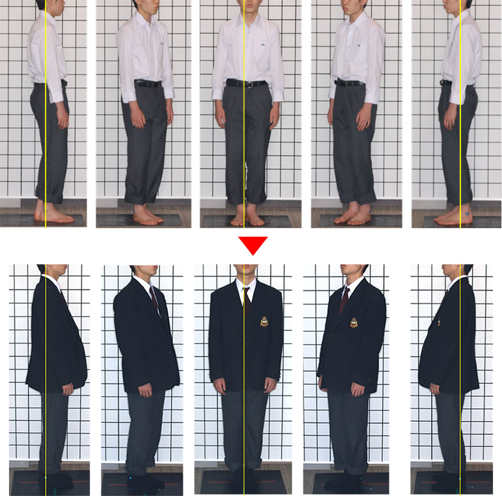 噛み合わせと身体のバランスを矯正治療で改善した症例