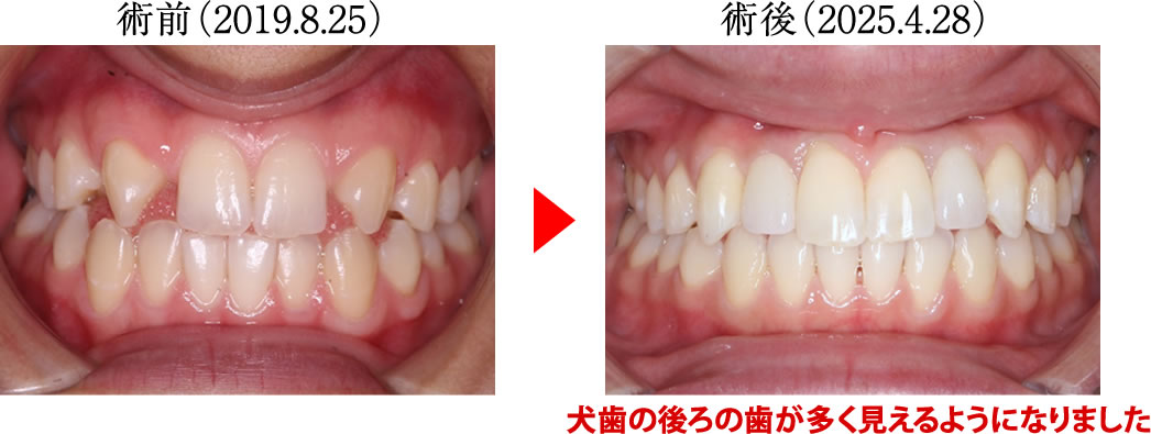 治療前後の比較