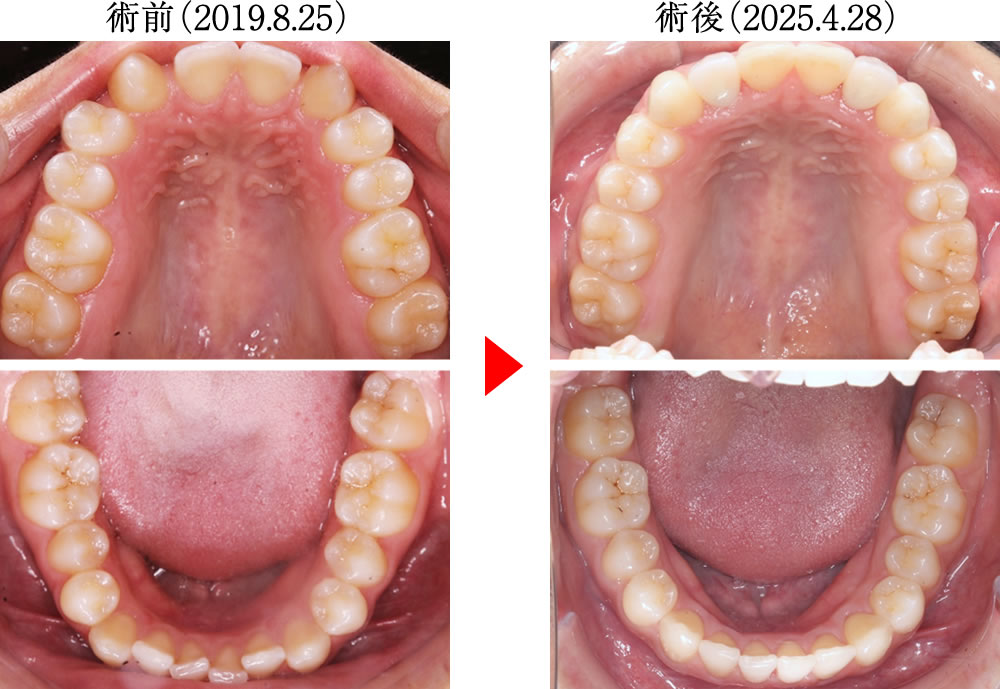 治療前後の比較