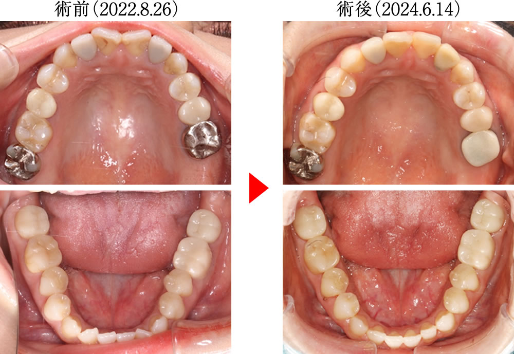治療前後の比較