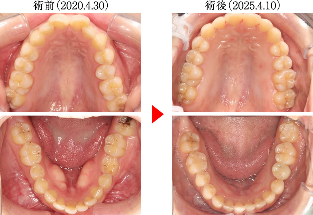 治療前後の比較