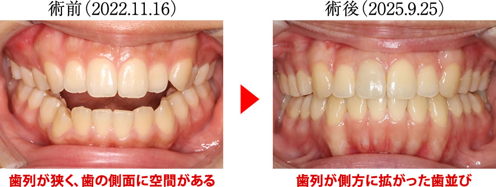 治療前後の比較