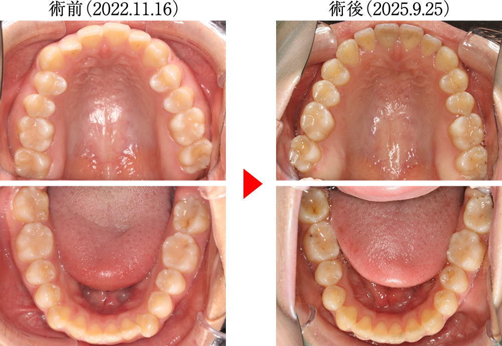 治療前後の比較