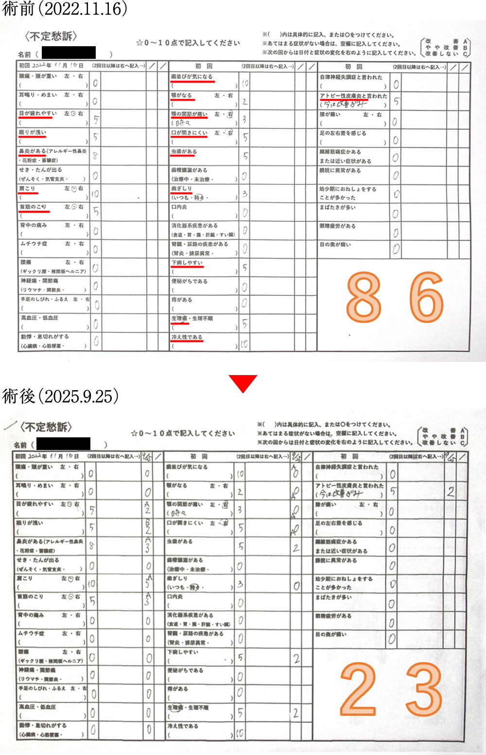 術前術後の骨格の変化