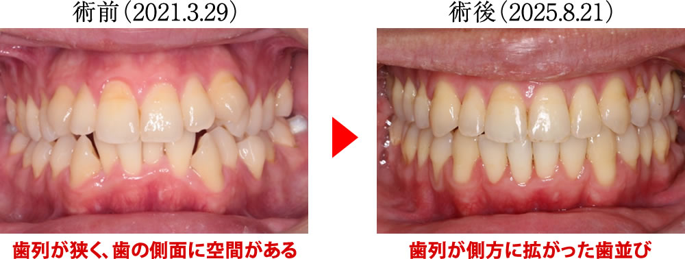 治療前後の比較