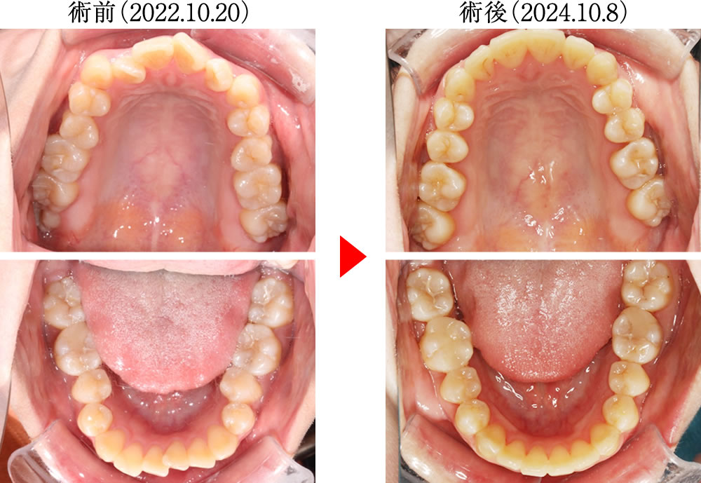 治療前後の比較
