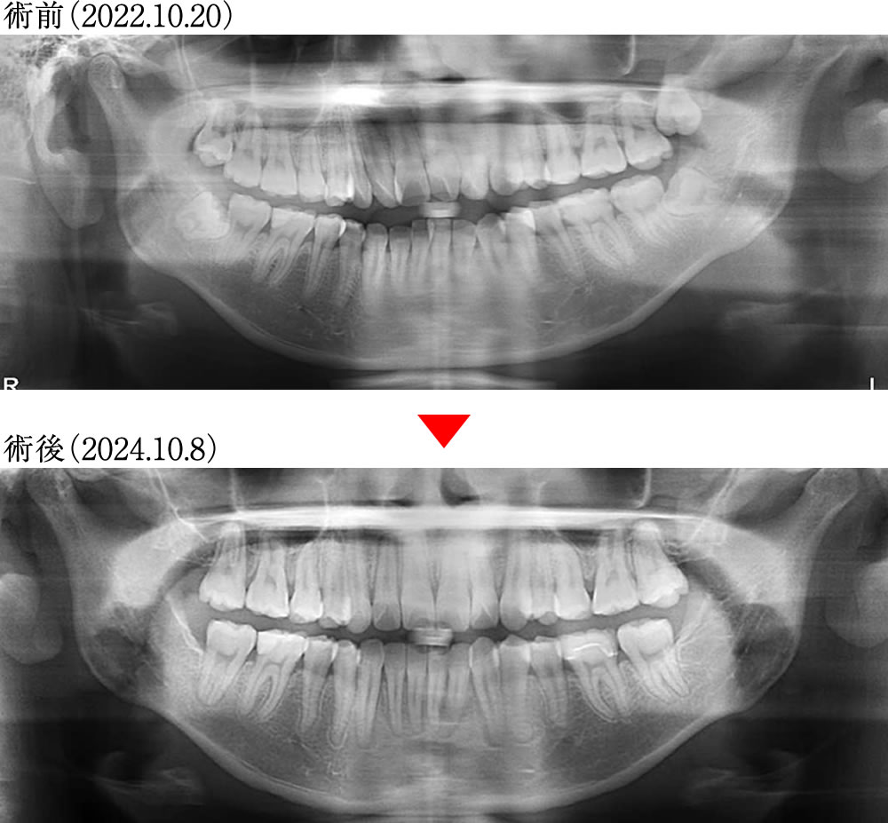 治療前後の比較