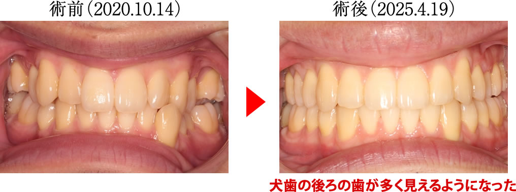 治療前後の比較