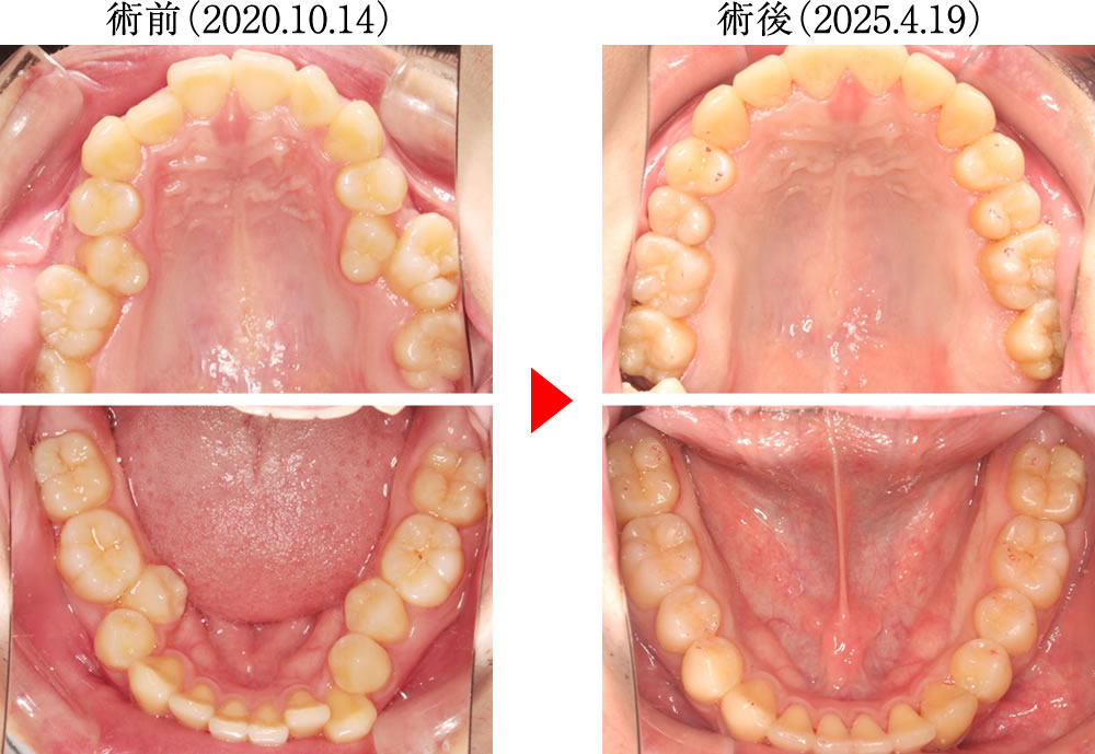 治療前後の比較