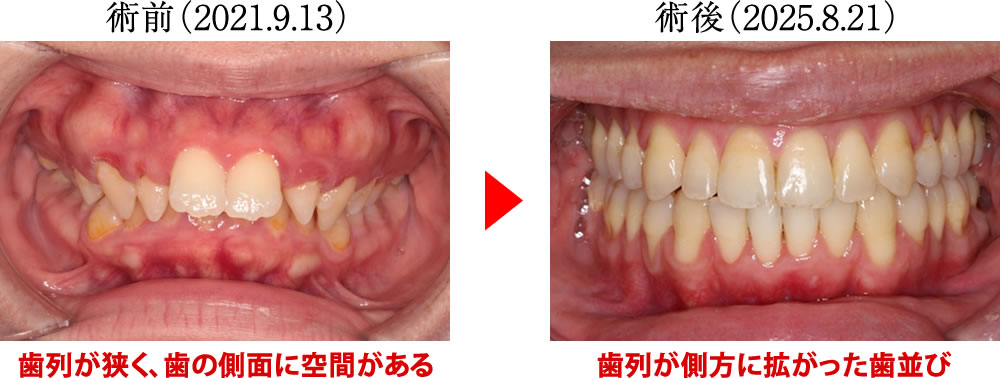 治療前後の比較