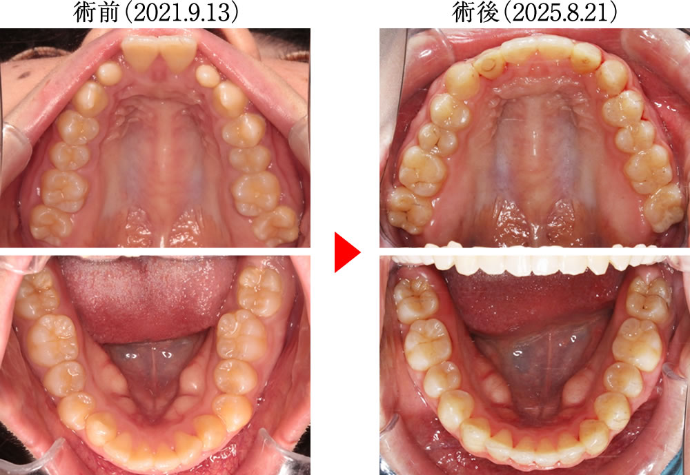治療前後の比較